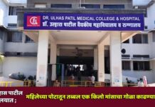 डॉ. उल्हास पाटील रुग्णालयात ; महिलेच्या पोटातून तब्बल एक किलो मांसाचा गोळा काढण्यात यश