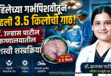 महिलेच्या गर्भपिशवीतून काढली ३.५ किलोची गाठ; डॉ. उल्हास पाटील रुग्णालयातील यशस्वी शस्त्रक्रिया
